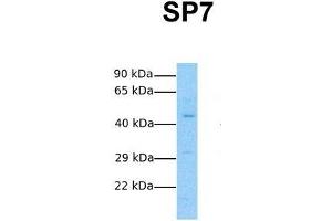 Host:  Rabbit  Target Name:  SP7  Sample Tissue:  Human Fetal Lung  Antibody Dilution:  1. (SP7 抗体  (N-Term))