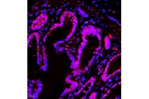 Immunofluorescence (Paraffin-embedded Sections) (IF (p)) image for anti-General Transcription Factor IIIC, Polypeptide 2, beta 110kDa (GTF3C2) antibody (ABIN7074038)