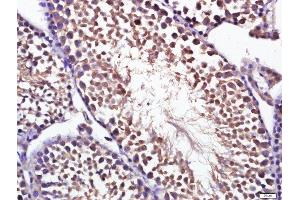 Paraformaldehyde-fixed, paraffin embedded mouse testis, Antigen retrieval by boiling in sodium citrate buffer (pH6. (OPTN 抗体  (AA 341-440))