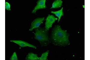 Immunofluorescence staining of U251 cells with ABIN7153827 at 1:133, counter-stained with DAPI. (RABGGTB 抗体  (AA 2-331))