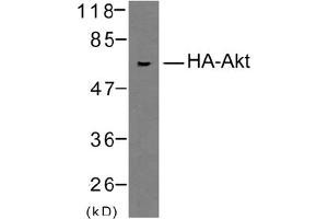 Image no. 1 for anti-HA-Tag antibody (ABIN319423) (HA-Tag 抗体)