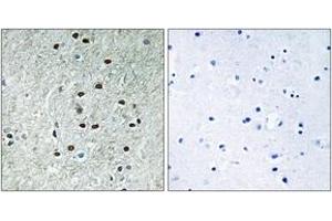 Immunohistochemistry analysis of paraffin-embedded human brain, using REXO1 Antibody. (REXO1 抗体  (AA 185-234))