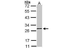WB Image Sample (30 ug of whole cell lysate) A: A431 , 10% SDS PAGE antibody diluted at 1:1000 (GK5 抗体  (Center))