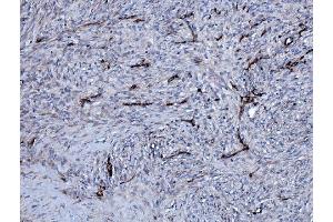 IHC analysis of EHD3 using anti-EHD3 antibody (ABIN7602777). (EHD3 抗体  (C-Term))