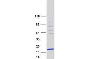 Western Blotting (WB) image for Chromosome 20 Open Reading Frame 30 (C20orf30) (Transcript Variant 2) protein (Myc-DYKDDDDK Tag) (ABIN2715476)