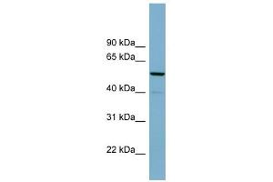 KIFC2 antibody used at 1 ug/ml to detect target protein. (KIFC2 抗体  (N-Term))