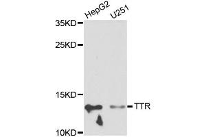 Western blot analysis of extracts of various cell lines, using TTR antibody (ABIN5970470) at 1/1000 dilution. (TTR 抗体)
