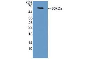 Western blot analysis of recombinant Mouse TGM1. (TGM1 抗体  (AA 337-607))