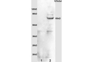 L1 rat brain lysates L2 mouse embryo lysates probed with Anti phospho-Cdc25B (Ser323) Polyclonal Antibody, Unconjugated (ABIN756952) at 1:200 overnight at 4 °C. (CDC25B 抗体  (pSer323))