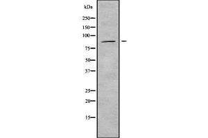 Western blot analysis of ADAM33 using HuvEc whole cell lysates (ADAM33 抗体  (Internal Region))