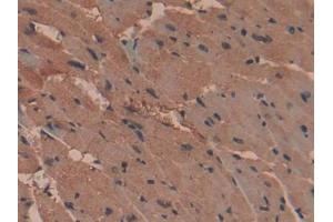 DAB staining on IHC-P; Samples: Mouse Heart Tissue (RNPEP 抗体  (AA 112-358))