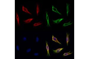 ABIN7094220 and ABIN7098266 staining Hela cells by IF/ICC. (FARS2 抗体  (Internal Region))