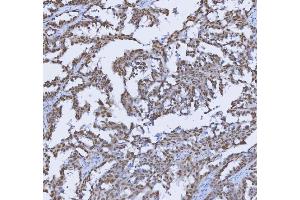 IHC analysis of TRMT6 using anti-TRMT6 antibody (ABIN7602138). (TRMT6 抗体  (AA 6-489))