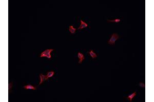 ABIN6266832 staining HeLa  cells by IF/ICC. (MAP4K4 抗体  (Internal Region))