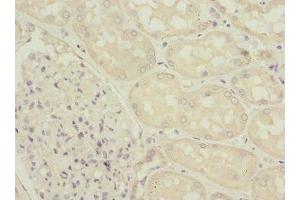 Immunohistochemistry of paraffin-embedded human kidney tissue using ABIN7176063 at dilution of 1:100 (ZFYVE16 抗体  (AA 1-280))