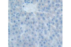 Figure. (EPOR 抗体  (AA 314-467))