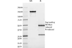 SDS-PAGE Analysis Purified CD10 Mouse Monoclonal Antibody (MME/1620). (MME 抗体)