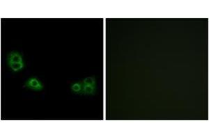 Immunofluorescence analysis of MCF7 cells, using TMEM185A Antibody. (TMEM185A 抗体  (AA 290-339))
