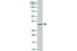 NRBP2 polyclonal antibody (A01), Lot # 060619JCS1 Western Blot analysis of NRBP2 expression in Y-79 . (NRBP2 抗体  (AA 151-258))