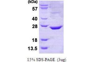 SDS-PAGE (SDS) image for CTD Small Phosphatase-Like Protein (CTDSPL) (AA 82-265) protein (His tag) (ABIN667673) (CTDSPL Protein (AA 82-265) (His tag))