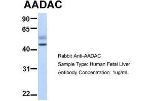 Host:  Rabbit  Target Name:  AADAC  Sample Type:  Human Fetal Liver  Antibody Dilution:  1. (AADAC 抗体  (N-Term))