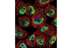 Fluorescent confocal image of  cell stained with KLF5 Antibody (C-term) (ABIN391515 and ABIN2841476). (KLF5 抗体  (C-Term))