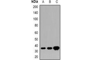 Western blot analysis of HOXD13 expression in U87MG (A), mouse brain (B), rat brain (C) whole cell lysates. (Homeobox D13 抗体)