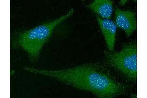ICC/IF analysis of FADD in HeLa cells line, stained with DAPI (Blue) for nucleus staining and monoclonal anti-human FADD antibody (1:100) with goat anti-mouse IgG-Alexa fluor 488 conjugate (Green). (FADD 抗体  (AA 1-208))