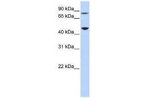 DPH2 antibody used at 1 ug/ml to detect target protein. (DPH2 抗体)