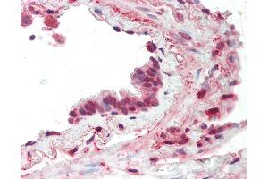 Anti-MCAM / CD146 antibody IHC staining of human lung, respiratory epithelium.