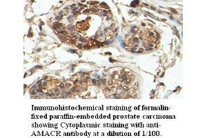 Image no. 1 for anti-alpha-Methylacyl-CoA Racemase (AMACR) antibody (ABIN791220) (AMACR 抗体)