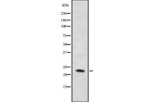 Western blot analysis of C56D2 using COS7 whole cell lysates (CYB561D2 抗体)