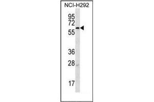 Western blot analysis of MBTPS2 Antibody (N-term) in NCI-H292 cell line lysates (35ug/lane). (MBTPS2 抗体  (N-Term))