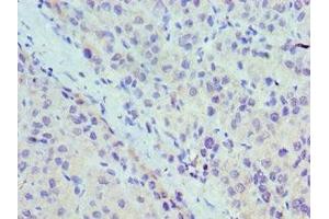 Immunohistochemistry (IHC) image for anti-Ubiquitin-Conjugating Enzyme E2, J2 (UBE2J2) (AA 1-230) antibody (ABIN7174459)