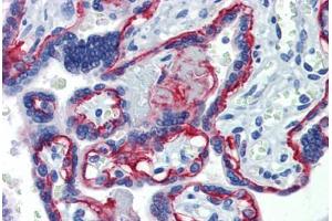 Placenta, Human: Formalin-Fixed, Paraffin-Embedded (FFPE) (Integrin beta 4 抗体)