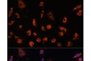 Immunofluorescence analysis of L929 cells using TMEM25 Polyclonal Antibody at dilution of 1:100. (TMEM25 抗体)