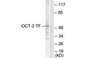 Western blot analysis of extracts from COS7 cells, using OCT2 Antibody. (Oct-2 抗体  (AA 1-50))