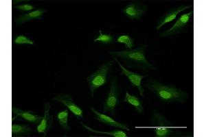 Immunofluorescence of purified MaxPab antibody to DDB1 on HeLa cell. (DDB1 抗体  (AA 1-1140))