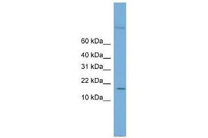 Cystatin 8 antibody used at 1 ug/ml to detect target protein. (CST8 抗体)