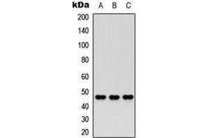 Western blot analysis of Nocturnin expression in HEK293T (A), PC12 (B), HeLa (C) whole cell lysates. (CCRN4L 抗体  (Center))