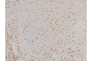 Immunohistochemistry (IHC) image for anti-Cofilin 1 (CFL1) (pSer3) antibody (ABIN6255180)
