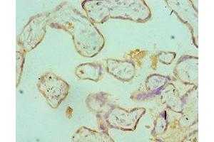 Immunohistochemistry of paraffin-embedded human placenta tissue using ABIN7171193 at dilution of 1:100 (Syndecan 1 抗体  (AA 25-240))