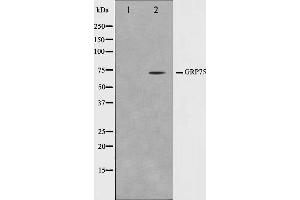 Western blot analysis on COS7 cell lysate using GRP75 Antibody,The lane on the left is treated with the antigen-specific peptide. (HSPA9 抗体)