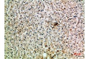 Immunohistochemical analysis of paraffin-embedded human-liver, antibody was diluted at 1:200 (TNIP2 抗体  (AA 61-110))