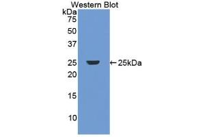 Detection of Recombinant DBP, Human using Polyclonal Antibody to Vitamin D Binding Protein (DBP) (Vitamin D-Binding Protein 抗体  (AA 209-401))