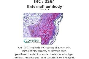 Image no. 1 for anti-Desmoglein 1 (DSG1) (Internal Region) antibody (ABIN1733615) (Desmoglein 1 抗体  (Internal Region))