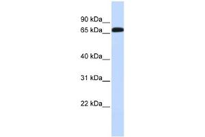 WB Suggested Anti-SLC6A1 Antibody Titration:  0. (SLC6A1 抗体  (Middle Region))