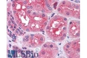 AP31109PU-N PREP antibody staining of Paraffin Embedded Human Kidney at 3. (PREP 抗体  (Internal Region))