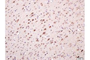 Paraformaldehyde-fixed, paraffin embedded rat brain tissue, Antigen retrieval by boiling in sodium citrate buffer(pH6) for 15min, Block endogenous peroxidase by 3% hydrogen peroxide for 20 minutes, Blocking buffer (normal goat serum) at 37°C for 30min, Antibody incubation with TMEM158 Polyclonal Antibody, Unconjugated  at 1:400 overnight at 4°C, followed by a conjugated secondary and DAB staining (TMEM158 抗体  (AA 188-260))