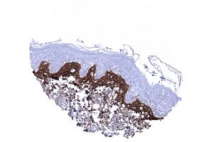 Skin Periostin is most regularly seen in a subepithelial band of variable thickness in the skin (Periostin 抗体  (AA 193-326))